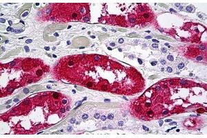 Human Kidney, Tubules: Formalin-Fixed, Paraffin-Embedded (FFPE) (Aminoacylase 1 antibody  (AA 1-409))