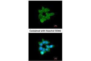ICC/IF Image Immunofluorescence analysis of methanol-fixed A431, using CLCA1, antibody at 1:200 dilution. (CLCA1 antibody)