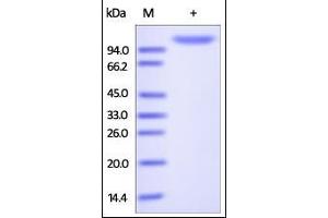 Human ENPP-2, His Tag on SDS-PAGE under reducing (R) condition. (ENPP2 Protein (AA 49-863) (His tag))