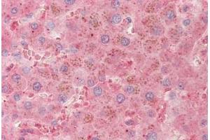 Human Liver: Formalin-Fixed, Paraffin-Embedded (FFPE) (PLG antibody)