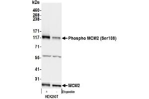 Western Blotting (WB) image for anti-Minichromosome Maintenance Complex Component 2 (MCM2) (pSer108) antibody (ABIN7449366)