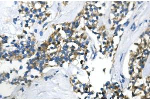 IHC analysis of UBR2 using anti-UBR2 antibody (ABIN7599609). (UBR2 antibody  (AA 10-664))