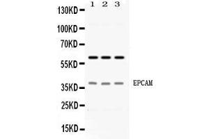 Western blot analysis of EPCAM expression in HELA whole cell lysates ( Lane 1), A549 whole cell lysates ( Lane 2) and PANC-1 whole cell lysates ( Lane 3). (EpCAM antibody  (Middle Region))