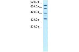 CDK7 antibody (20R-1296) used at 0. (CDK7 antibody  (C-Term))