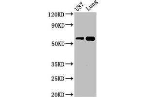 Western Blot Positive WB detected in: U87 whole cell lysate, Mouse lung tissue All lanes: SHC3 antibody at 3 μg/mL Secondary Goat polyclonal to rabbit IgG at 1/50000 dilution Predicted band size: 65, 52 kDa Observed band size: 65 kDa (SHC3 antibody  (AA 323-468))