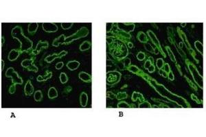 Reactivity of laminin α5 chain specific monoclonal antibody 4B12 on human embryonic lung alveolae epithelium (A) and kidney (B) preparation (Laminin 5 antibody)