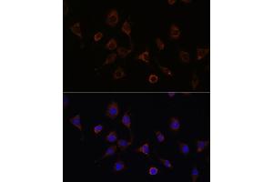 Immunofluorescence analysis of L929 cells using NFS1 Rabbit pAb (ABIN6130225, ABIN6144595, ABIN6144597 and ABIN6222373) at dilution of 1:100 (40x lens).
