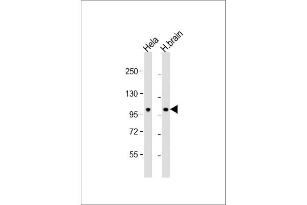 NCOA7 Antikörper  (N-Term)