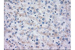 Immunohistochemical staining of paraffin-embedded liver tissue using anti-OXSR1mouse monoclonal antibody. (OXSR1 antibody)
