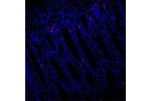 Immunofluorescent analysis of paraffin-embedded human colon using EIF2S2 (ABIN7073880) at dilution of 1: 1000 (EIF2S2 antibody)