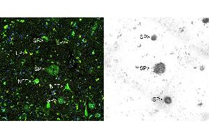 Immunohistochemical analysis of paraffin-embedded Alzheimer's hippocampus using Thioflavin S (left panel) and Beta Amyloid antibody using the HRP-DAB staining technique. (beta Amyloid antibody)