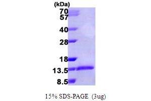SDS-PAGE (SDS) image for Chemokine (C-C Motif) Ligand 3 (CCL3) (AA 24-92) protein (His tag) (ABIN666794)