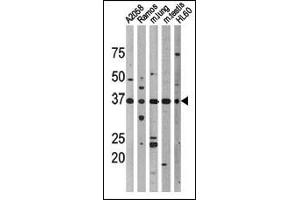 Western blot analysis of anti-Phospho-p53-T18 Pab (cat (ABIN389626 and ABIN2839626)) in, from left to right, , Ramos, mouse lung, mouse testis, and HL60 cell line lysates. (p53 antibody  (pThr18))