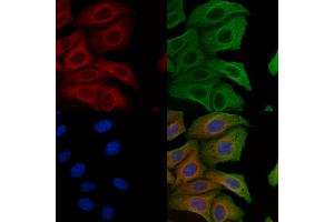 ABIN6257631 and ABIN6274765 staining Hela cells by IF/ICC. (RPL10A antibody  (C-Term))