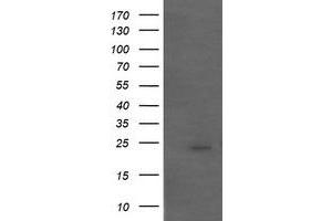 Image no. 1 for anti-Amyloid P Component, Serum (APCS) antibody (ABIN1500899) (APCS antibody)