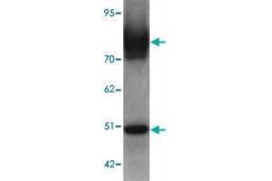 Western blot analysis of SLC39A6 in mouse lung tissue lysate with SLC39A6 polyclonal antibody  at 1 ug/mL. (SLC39A6 antibody  (Internal Region))