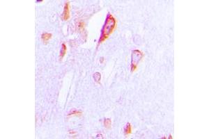 Immunohistochemical analysis of Cytochrome P450 1A1/2 staining in human brain formalin fixed paraffin embedded tissue section. (CYP1A1/2 antibody  (Center))