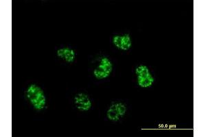 Immunofluorescence of monoclonal antibody to C6orf139 on HeLa cell. (CENPQ antibody  (AA 1-268))