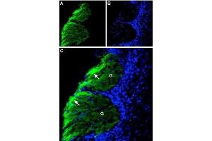 Immunohistochemistry (IHC) image for anti-Neural Cell Adhesion Molecule 1 (NCAM1) (AA 261-276), (Extracellular) antibody (ABIN7043350)
