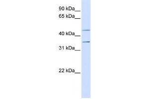 Western Blotting (WB) image for anti-Purinergic Receptor P2Y, G-Protein Coupled, 12 (P2RY12) antibody (ABIN2459481) (P2RY12 antibody)