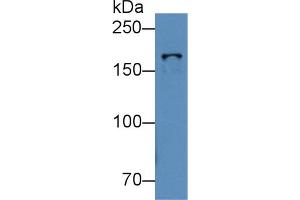 Western Blot; Sample: Human K562 cell lysate; Primary Ab: 2µg/mL Rabbit Anti-Mouse TOP2b Antibody Second Ab: 0. (TOP2B antibody  (AA 446-655))