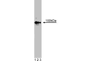 Western Blotting (WB) image for anti-Cadherin 4 (CDH4) (AA 22-201) antibody (ABIN967954) (Cadherin 4 antibody  (AA 22-201))