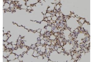 ABIN6276956 at 1/100 staining Mouse lung tissue by IHC-P.