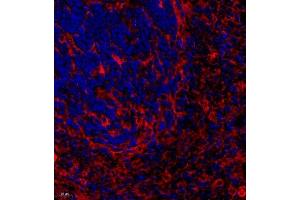 Immunofluorescence of paraffin embedded rat spleen using CYP2S1 (ABIN7073673) at dilution of 1:600 (400x lens) (CYP2S1 antibody)