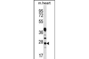 CRYBA1 Antibody (Center) (ABIN656311 and ABIN2845613) western blot analysis in mouse heart tissue lysates (35 μg/lane). (CRYBA1 antibody  (AA 104-133))