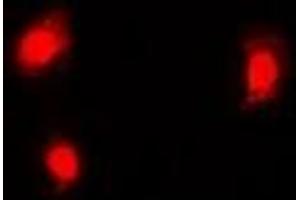 Immunofluorescent analysis of EMSY staining in Hela cells. (EMSY antibody)