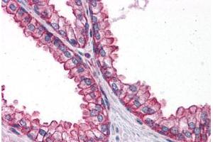 Human Prostate: Formalin-Fixed, Paraffin-Embedded (FFPE) (PTER antibody  (C-Term))
