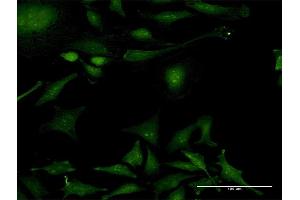 Immunofluorescence of purified MaxPab antibody to PPIL2 on HeLa cell. (PPIL2 antibody  (AA 1-527))