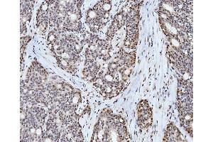 IHC analysis of Cyclophilin E/PPIE using anti-Cyclophilin E/PPIE antibody (ABIN7599242). (PPIE antibody  (AA 1-301))