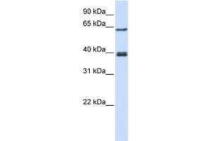 WB Suggested Anti-IKZF3 Antibody Titration:  0.