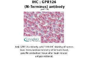 Image no. 1 for anti-G Protein-Coupled Receptor 126 (GPR126) (N-Term) antibody (ABIN1734925) (G Protein-Coupled Receptor 126 antibody  (N-Term))