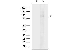 Western blot analysis of lysates from Hela cells, using ZAK Antibody.