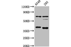 Western Blot Positive WB detected in: A549 whole cell lysate, 293 whole cell lysate All lanes: CTSS antibody at 1:4000 Secondary Goat polyclonal to rabbit IgG at 1/50000 dilution Predicted band size: 38, 32 kDa Observed band size: 38 kDa (Cathepsin S antibody  (AA 115-331))