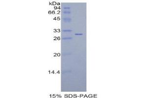SDS-PAGE (SDS) image for Isocitrate Dehydrogenase 1 (NADP+), Soluble (IDH1) (AA 78-330) protein (His tag) (ABIN2121473) (IDH1 Protein (AA 78-330) (His tag))