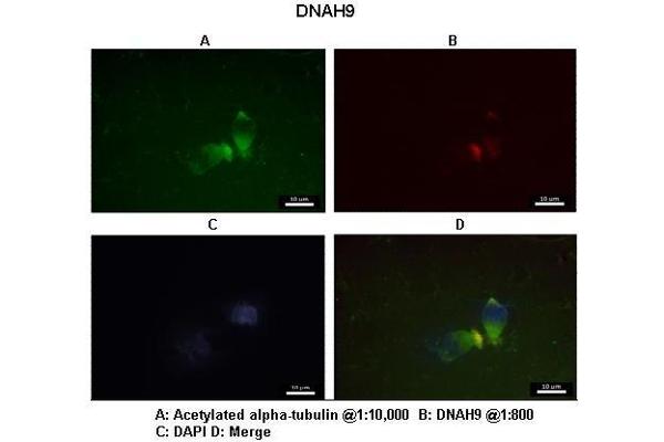 DNAH9 anticorps  (C-Term)