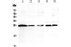 Western blot analysis of IL36 alpha using anti-IL36 alpha antibody .