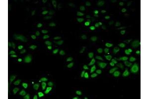 Detection of PDHX in Human Hela Cells using Polyclonal Antibody to Pyruvate Dehydrogenase Complex Component X (PDHX) (PDHX antibody  (AA 220-468))