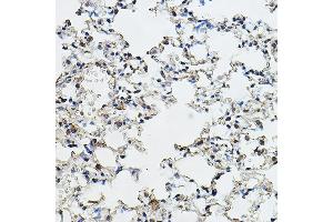 Immunohistochemistry of paraffin-embedded mouse lung using Cyclin E1 Rabbit pAb (ABIN7266565) at dilution of 1:150 (40x lens). (Cyclin E1 antibody  (AA 300-410))
