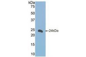 anti-Fc Fragment of IgE, Low Affinity II, Receptor For (CD23) (FCER2) (AA 150-330) antibody