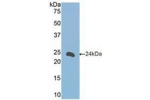 Detection of Recombinant FceRII, Mouse using Polyclonal Antibody to Cluster Of Differentiation 23 (CD23) (FCER2 antibody  (AA 150-330))