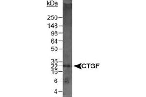 Western blot analysis of CTGF in mouse kidney lysate using CTGF polyclonal antibody . (CTGF antibody  (AA 299-349))