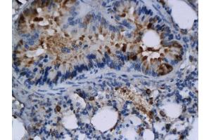 Formalin-fixed and paraffin embedded mouse lung labeled with Anti-TNFSF4/CD252 Polyclonal Antibody, Unconjugated (ABIN740640) followed by conjugation to the secondary antibody (TNFSF4 antibody  (AA 141-199))