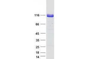 Validation with Western Blot (Unc5c Protein (Myc-DYKDDDDK Tag))