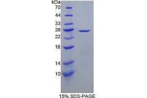 SDS-PAGE (SDS) image for Glial Fibrillary Acidic Protein (GFAP) (AA 256-357) protein (His tag,GST tag) (ABIN1079643) (GFAP Protein (AA 256-357) (His tag,GST tag))