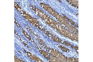 IHC analysis of Mucin-5AC using anti-Mucin-5AC antibody (ABIN3043460). (MUC5AC antibody  (AA 4848-5030))