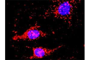 Proximity Ligation Analysis of protein-protein interactions between DVL1 and CTNNB1. (DVL1 antibody  (AA 1-444))